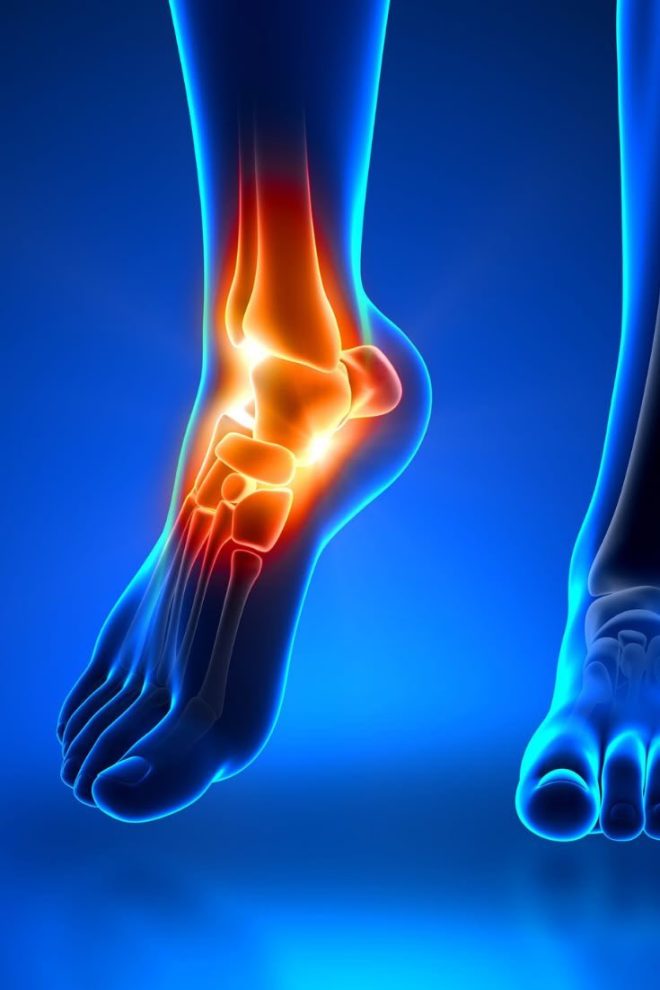 Shocking Truth Behind Your Joint Pain Revealed! — Joint discomfort relief, Chronic joint inflammation, Natural remedies for arthritis
