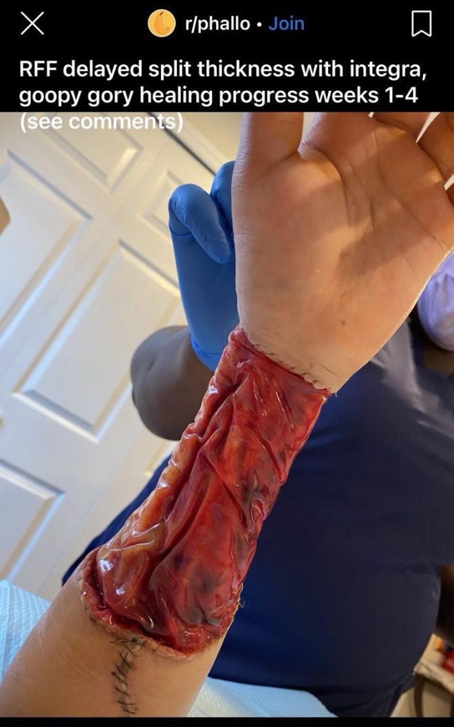 Shocking Truth: What 'Gender Affirming Care' Really Involves — graphic content, shocking imagery, explicit visuals