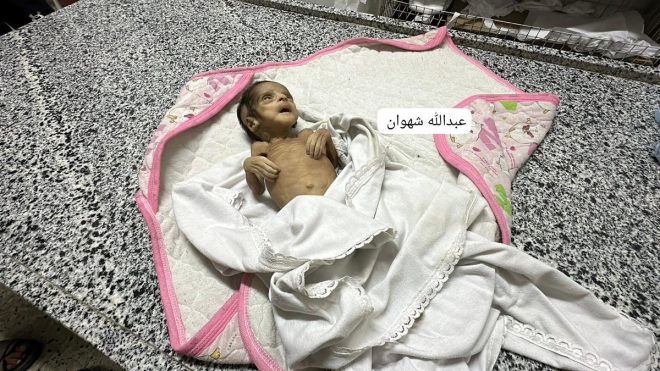Starvation Crisis: Two-Month-Old Baby Dies in Gaza! — Gaza humanitarian crisis, malnutrition deaths in Gaza 2025, infant starvation statistics Gaza