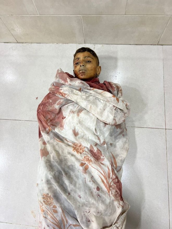 Starving Boy's Tragic Return: No One Recognizes Him — starving children in conflict zones, humanitarian crisis in Gaza, impact of war on families