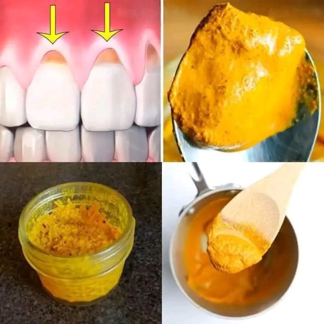 Swap Pills for Lemon Water: 13 Shocking Secrets! — Holistic wellness strategies, refreshing detox beverages, vitamin C powerhouse drinks