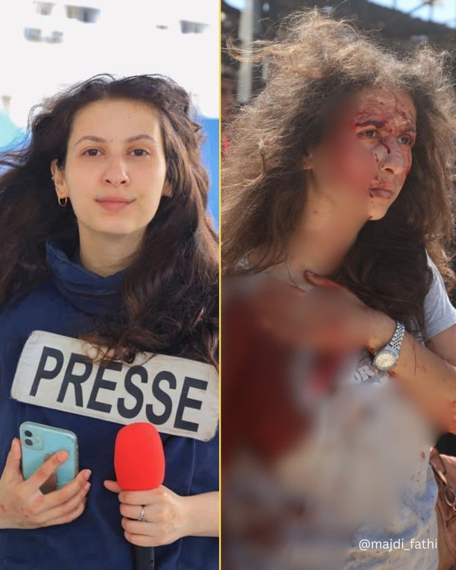 Wounded Journalist Sparks Outrage: Gaza Cafe Attack! 🚨 — Palestinian conflict news, Gaza City violence updates, Al-Baqa cafe attack report