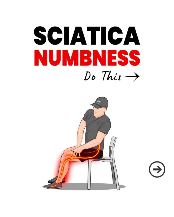 "Sciatica Shock: Numb Legs Revealed—Unseen Relief!" — Herniated Disc Relief, Nerve Compression Treatment, Leg Pain Management