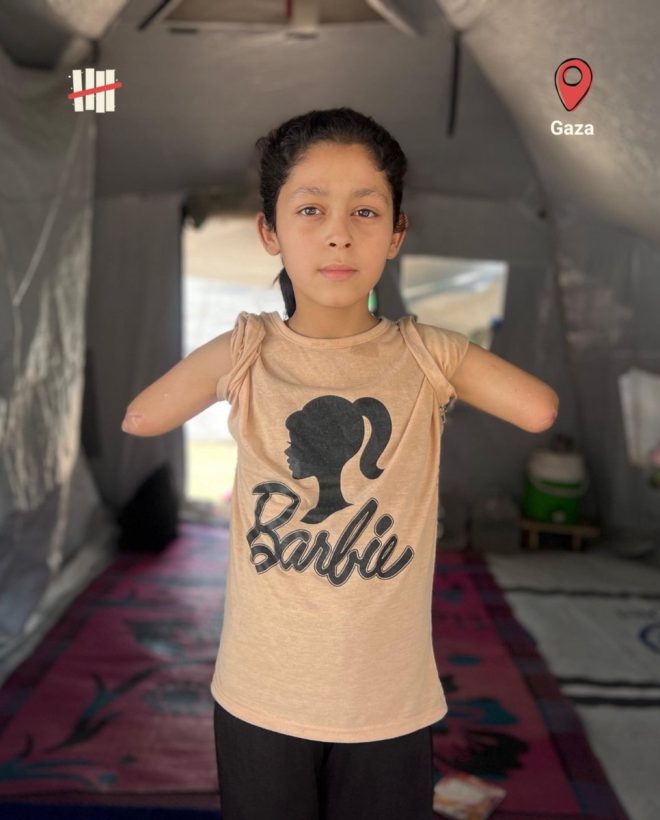 10-Year-Old Gaza Girl Loses Arms in Airstrike: Outrage! — Gaza airstrike survivor, Palestinian child tragedy, Israeli airstrike impact 2025