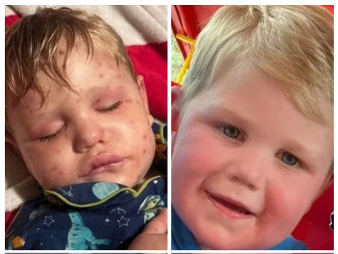 Boy Stung 150 Times by Wasps: Is Nature Out for Revenge? — prayers for accident victims, yellow jacket sting treatment, Savannah GA medical emergency