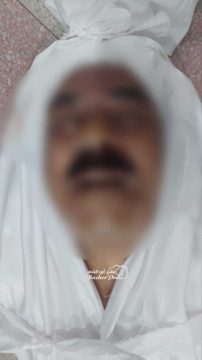 Controversial Strike: Doctor Killed in Gaza Market Attack! — Gaza City news, Israeli airstrike casualties, Al-Ahli Baptist Hospital incident