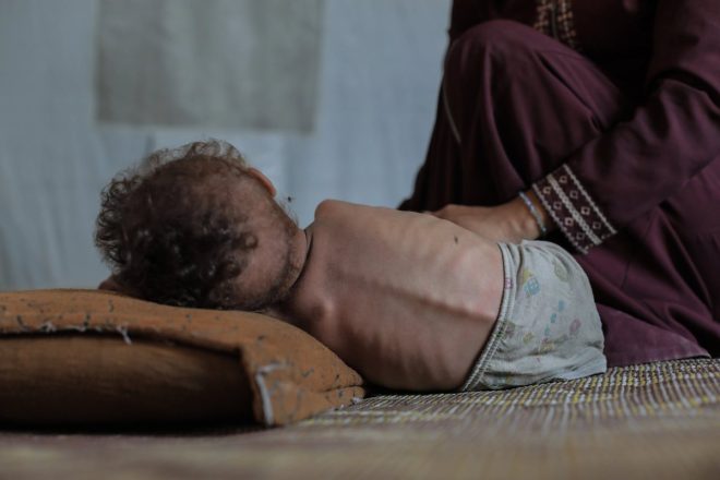 3-Year-Old Palestinian's Struggle in Gaza's Tent City —  Displaced Palestinian children, Gaza refugee crisis, Nuseirat camp conditions