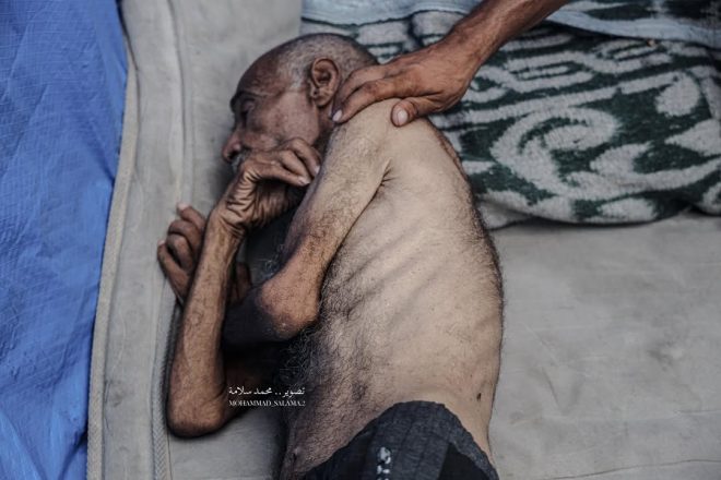 Blockade Crisis: Hassan's Dire Health Plea Ignored! —  humanitarian crisis 2025, malnutrition effects, access to healthcare challenges