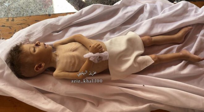 Child's Death from Famine in Gaza: Who's to Blame? —  Gaza humanitarian crisis, Gaza child famine 2025, Israeli siege impact on children