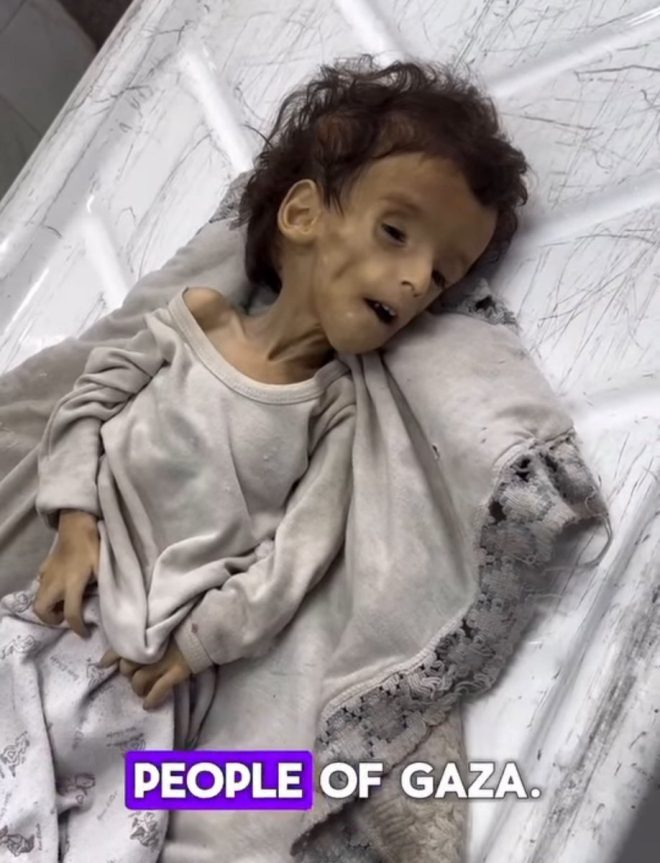 Mass Starvation: 2 Million at Risk Amid Chaos and Bombing! — humanitarian crisis 2025, famine relief efforts, civilian casualties in conflict zones