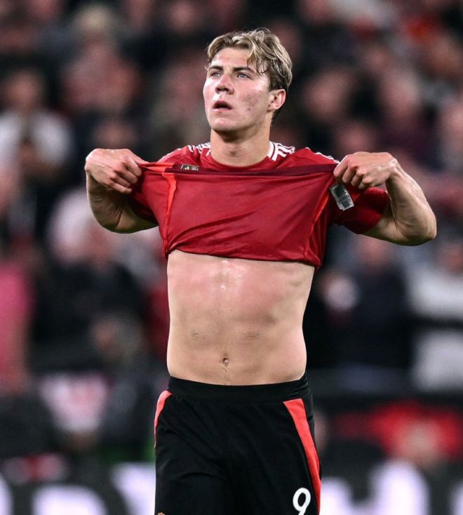 🚨 Rasmus Hojlund's Shocking Exclusion: What’s Next? — Rasmus Hojlund injury update, Arsenal match preview, Ruben Amorim squad news