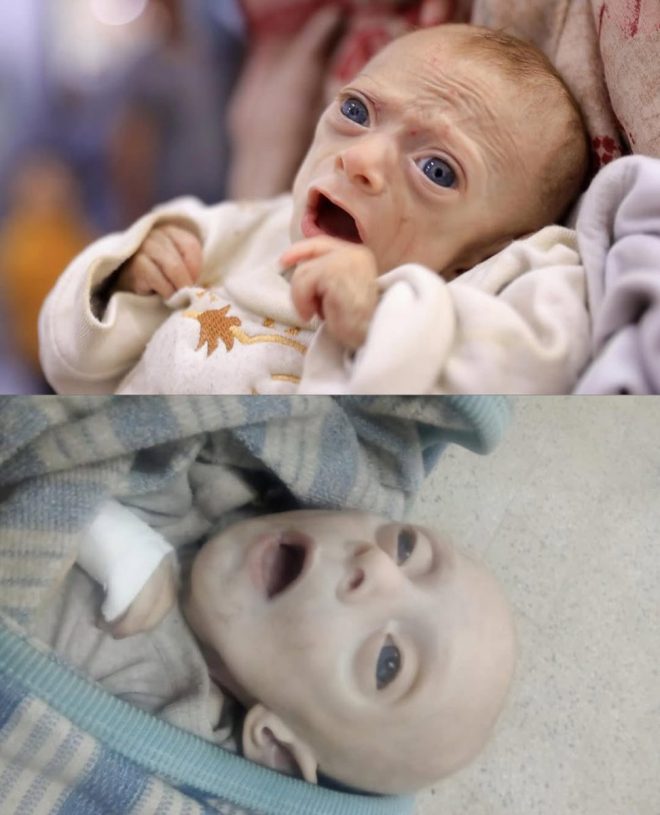 Starvation Tragedy: Baby Rafif Al Sousi Dies Under Occupation! —  malnourished children Gaza, starvation crisis Palestine, humanitarian disaster 2025
