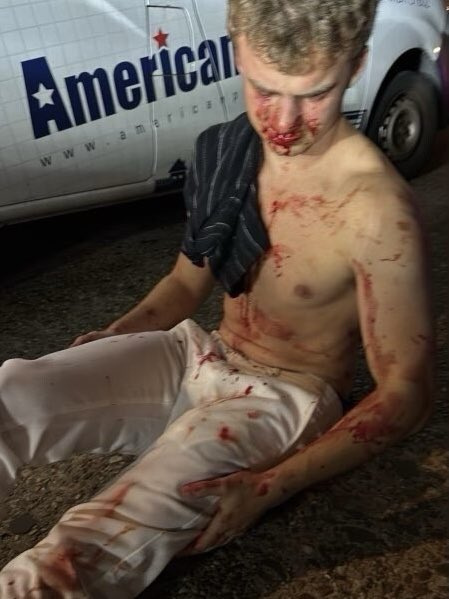 Young Hero Beaten in DC: Is Violence Out of Control? —  street violence DC, defend against assault, public safety concerns 2025