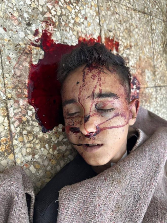 "Fatal Israeli bombing in Gaza claims lives of four, including innocent boy - shocking details emerge!" — Israeli bombing casualties, Gaza City tragedy, Al Sabra neighborhood incident