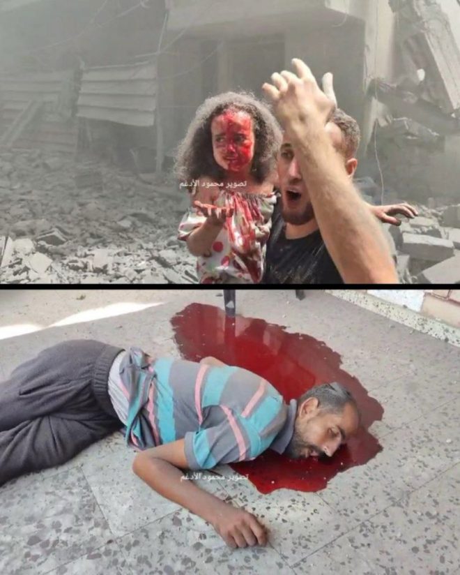 Outrage Erupts: Civilians, Including Kids, Killed in Gaza — Israeli airstrikes civilian casualties Gaza 2025, Sheikh Radwan neighborhood conflict news, humanitarian crisis Gaza children victims