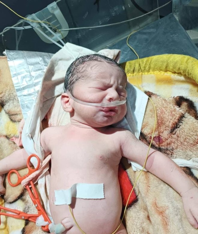 Shock and Outrage: Baby Born Amid Gaza's Tragic Bombing — Gaza conflict news, emergency C-section survival stories, orphaned baby in war zone