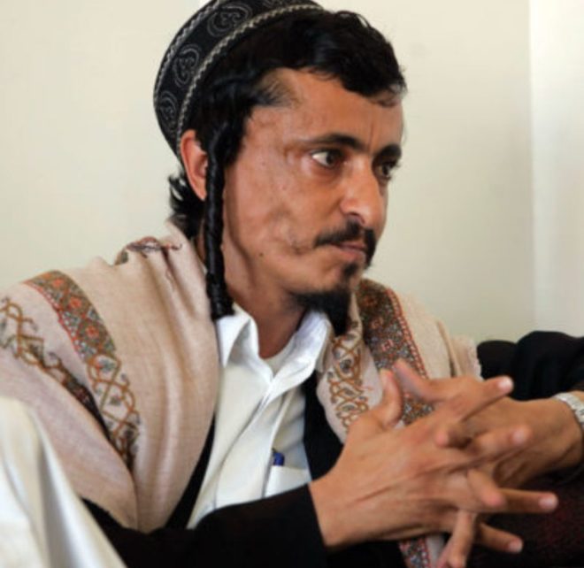 Silence on Torture: Yemeni Jew's Plight Ignored Worldwide —  Yemen human rights violations, Jewish persecution in Yemen, Houthis arrest of Levi Marhabi