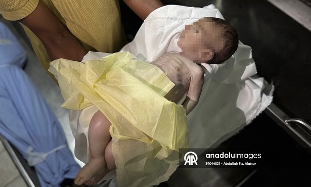 Tragic Death of Infant Highlights Gaza's Dire Crisis! —  humanitarian crisis in Gaza, infant mortality in conflict zones, malnutrition in Palestinian territories