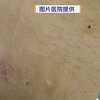 惊险！8岁男童昏迷9小时竟因毒蛇咬伤 —  毒蛇咬伤急救, 小孩昏迷原因, 韶关医疗新闻