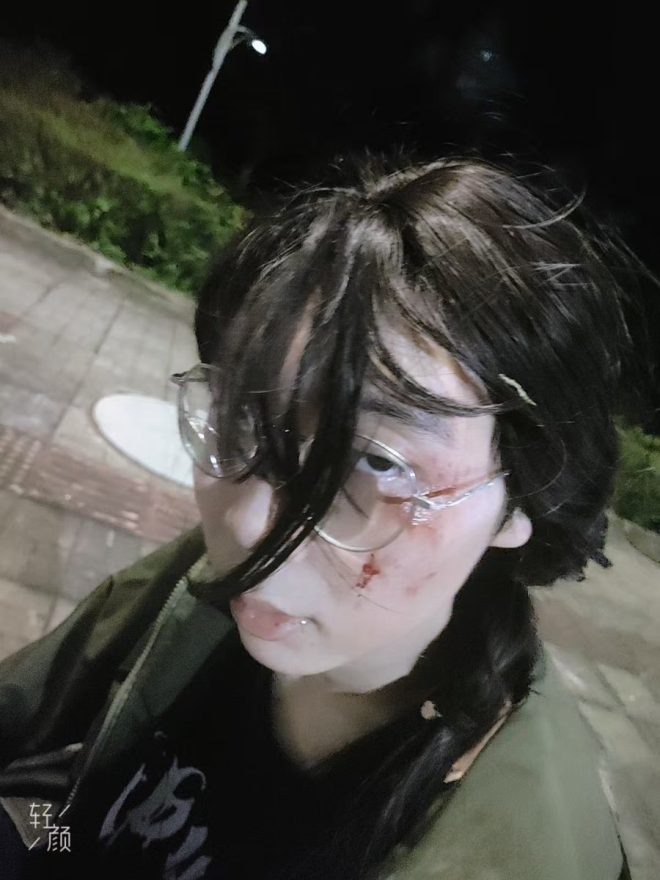 月尘后驾驶危险！你绝对想不到的后果！ —  驾驶安全警示, 月尘药效危害, 车辆翻车事故分析