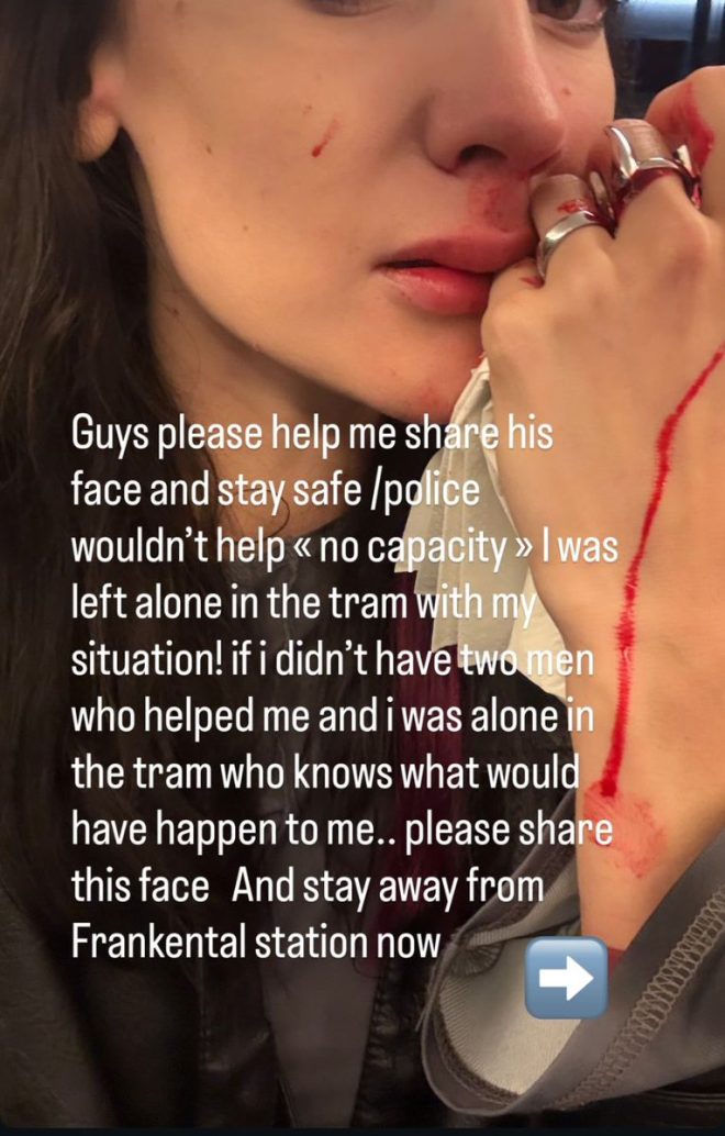 蘇黎世電車驚魂：無法出警的背後真相 —  暴力事件, 警力不足, 蘇黎世治安