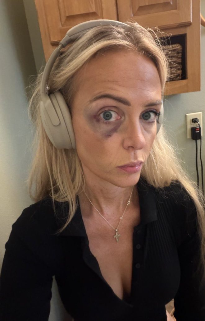 Portland PD Arrests Journalist, Not Antifa Attacker! — Alert, Notification, Warning